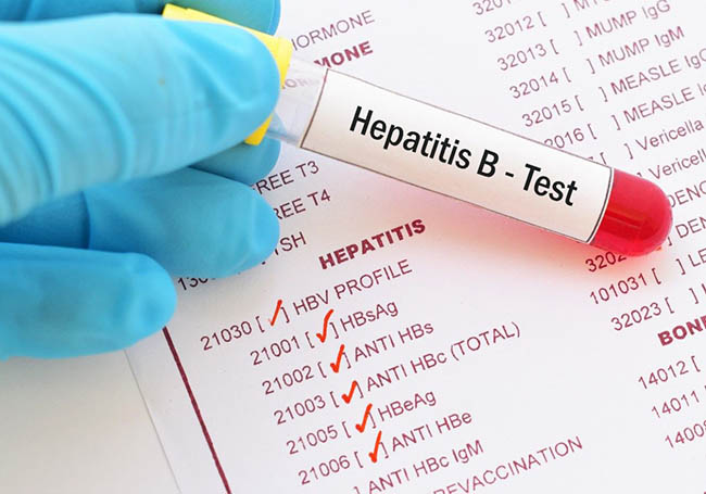 Hepatitis Day highlights the silent killer