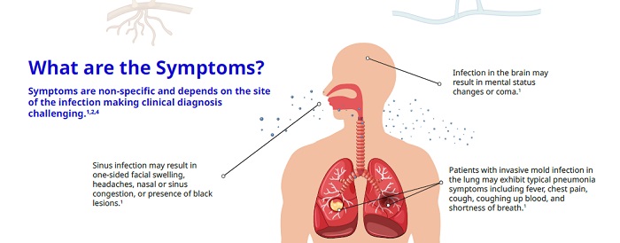 rare but deadly fungal disease